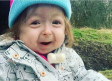 Pequeña de 2 años edad padece la extraña enfermedad de Benjamin Button