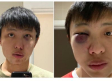 Estudiante es brutalmente atacado al ser señalado como portador del Coronavirus