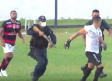 Policía dispara a un jugador en una pierna por riña