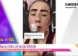 Joven intenta reto viral de 'Tik Tok' y termina con el rostro como 