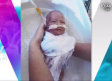 Sobrevive bebé que nace pesando solo 350 gramos