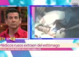 Operan a menor de 16 años que se comía su cabello