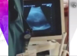 Doctor da vuelta con sus manos a bebé dentro del útero