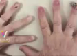 Mujer sufre extraña enfermedad que le hace perder sus uñas