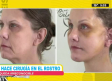 Se hace cirugía en el rostro y queda irreconocible