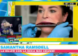 Ella es la mujer con la boca más grande del mundo