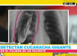 Detectan cucaracha gigante en pulmon de paciente