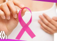 Lo que tienes que saber sobre la prevención del cáncer de mama