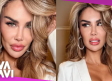 Ninel Conde se somete a cirugía para cambiarse el color de ojos