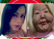 Influencer inicia reconstrucción facial tras vivir con el rostro desfigurado
