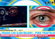 ¿Qué son las 'perrillas' en los ojos?