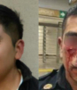 Joven muerde y arranca pedazo de nariz a policía que lo regaño por orinar en el Metro