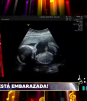 Vivian Cepeda confirma estar embarazada
