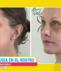 Se hace cirugía en el rostro y queda irreconocible