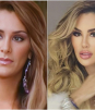 Ninel Conde: el antes y después de sus cirugías