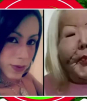 Influencer inicia reconstrucción facial tras vivir con el rostro desfigurado