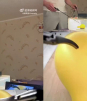 Cirujano cose globo sin que se reviente