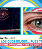 ¿Qué son las 'perrillas' en los ojos?