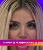 Tamara se somete a operación para cambiarse el color de sus ojos
