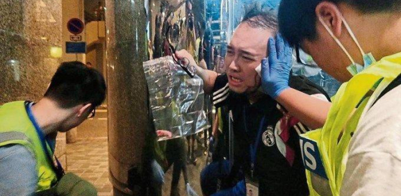 Arranca de una mordida la oreja durante protesta en Hong Kong