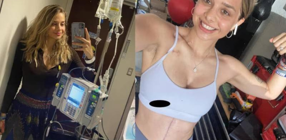Chica va a consulta por eructar demasiado y le dan fatal resultado