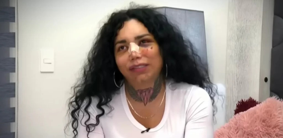 Fan se tatúa rostro golpeado de Paola Suárez y causa controversia