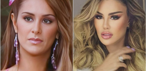 Ninel Conde: el antes y después de sus cirugías