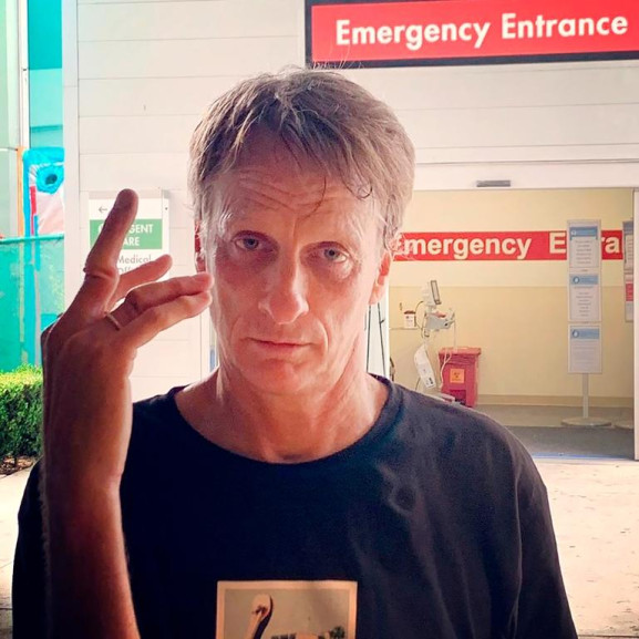 Las impactantes imágenes de la mano fracturada de Tony Hawk 